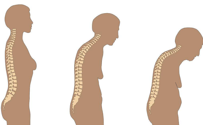 超聲骨密度測(cè)量?jī)x廠家分析因衰老骨骼的變化