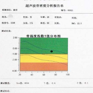 骨密度檢測儀針對骨密度檢測結(jié)果的分析