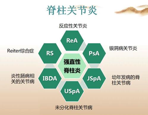 超聲骨密度測定儀廠家提醒越歇息腰越痛當(dāng)心得了“脊柱關(guān)節(jié)炎”